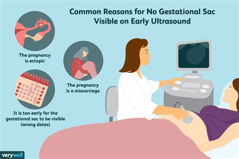 What No Gestational Sac on the Ultrasound Means